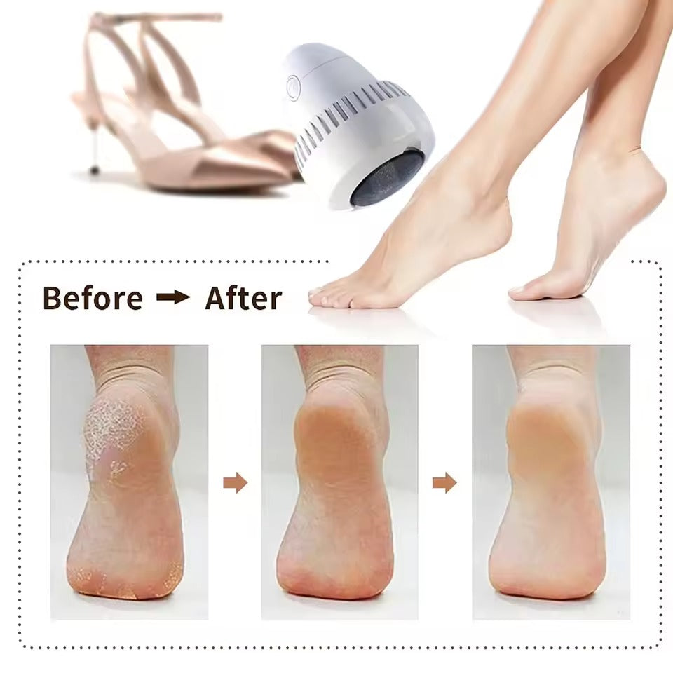 Electric Foot File Grinder
